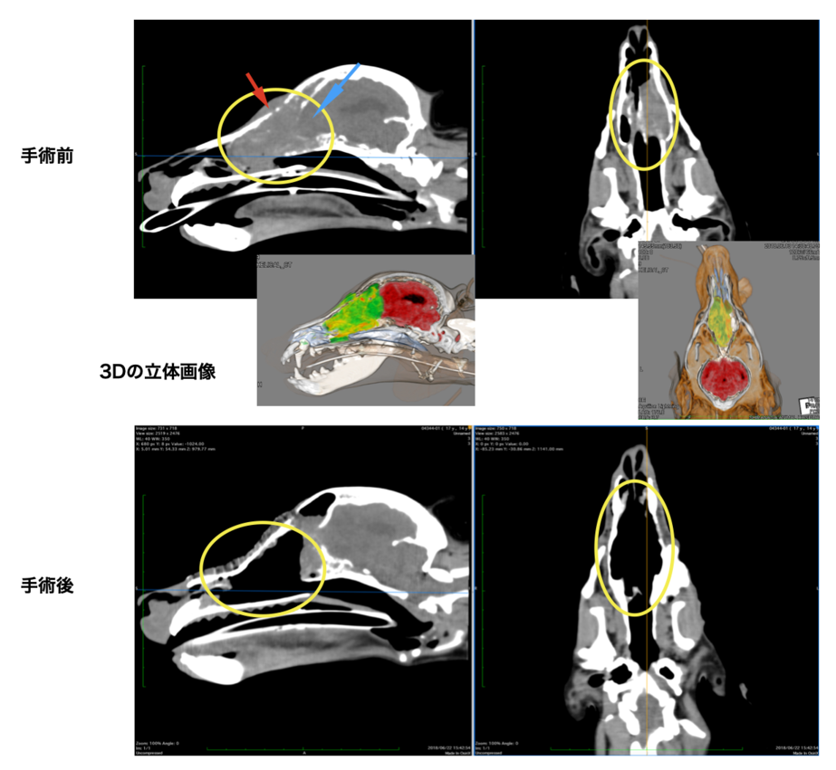 症例1：鼻腔内腫瘍