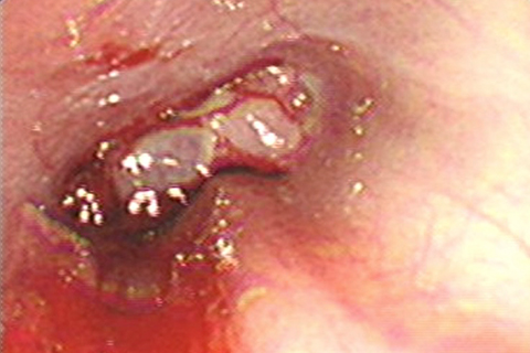 症例6：鼻腔内の内視鏡検査