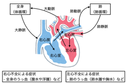 心臓病とは