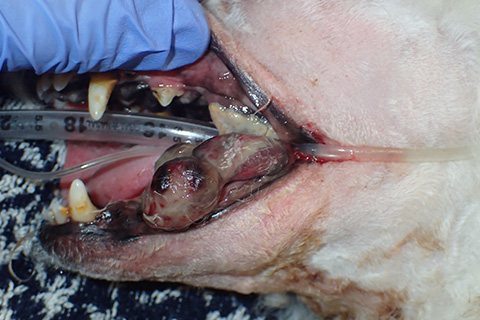 例2：左の下顎にできた腫瘍